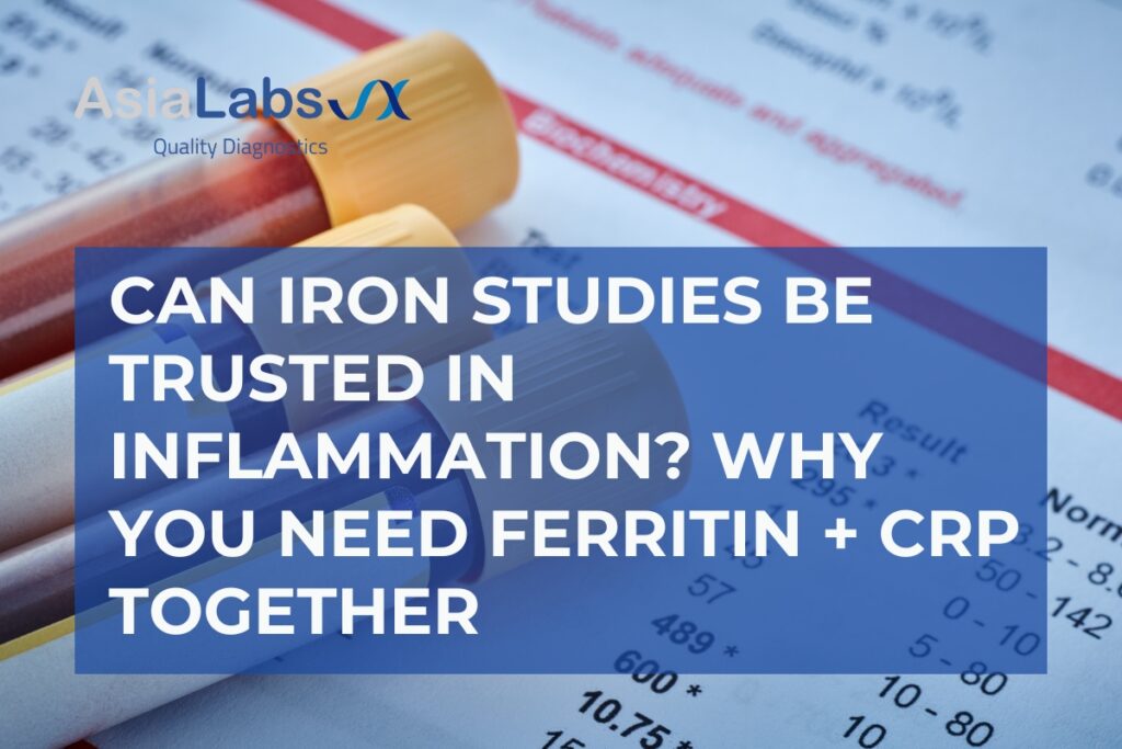 Can Iron Studies Be Trusted in Inflammation Why You Need Ferritin + CRP Together
