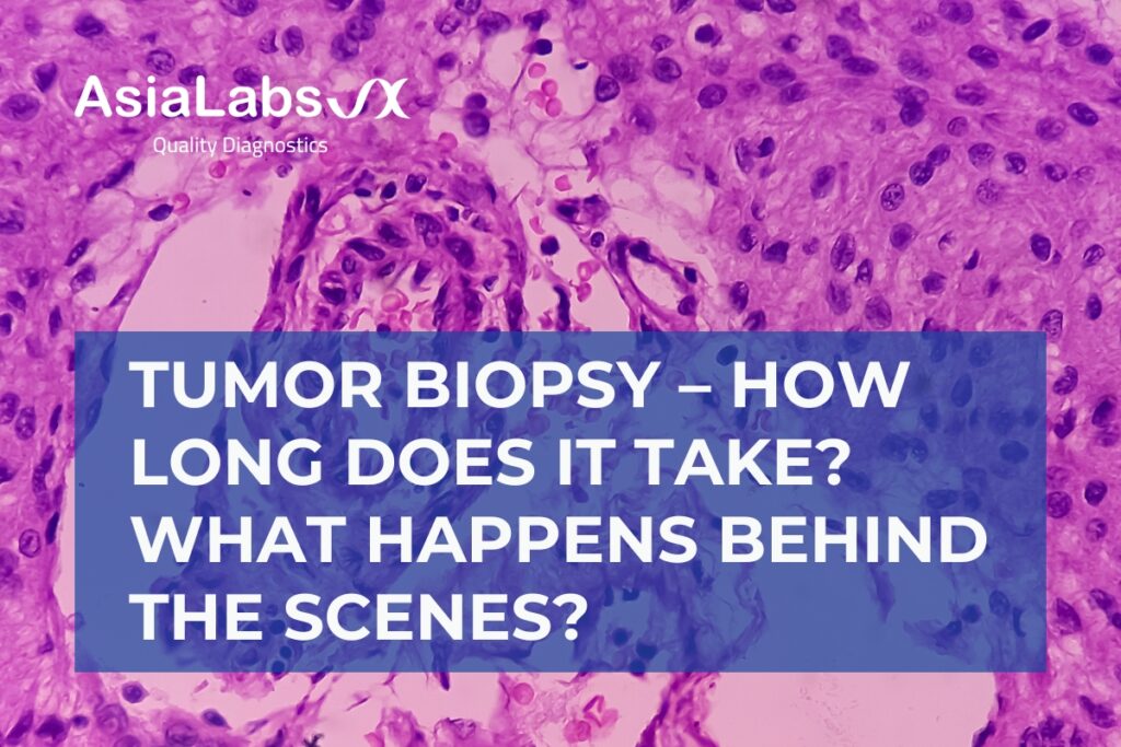 Tumor Biopsy – How Long Does It Take What Happens Behind the Scenes