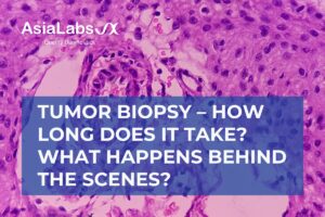Tumor Biopsy – How Long Does It Take What Happens Behind the Scenes