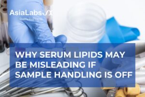 Why Serum Lipids May Be Misleading If Sample Handling Is Off