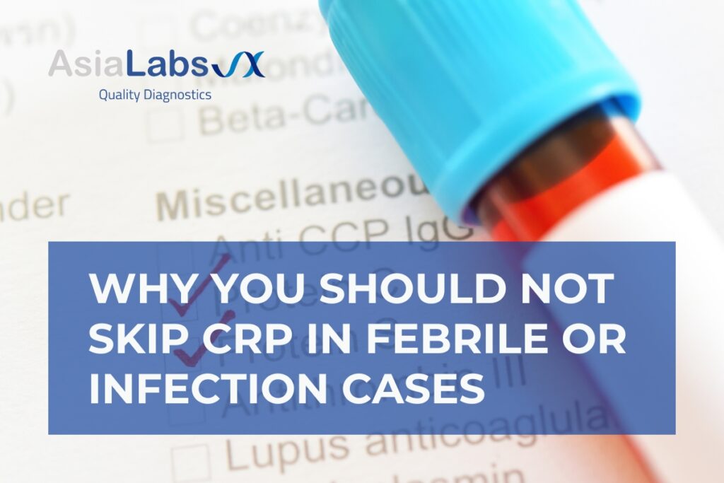 Why You Should Not Skip CRP in Febrile or Infection Cases